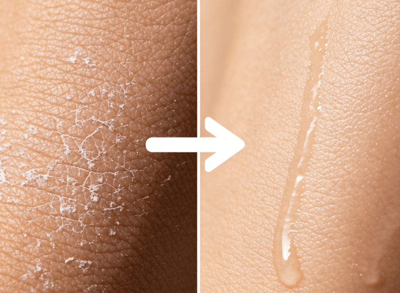 干性肤质解析及护肤方法插图