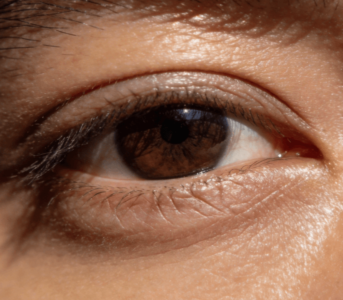 肌肤无光泽:营养调理与护肤结合,重拾透亮感 肌肤无光泽:营养调理与护肤结合,重拾透亮感