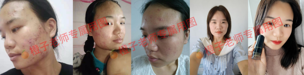 伊的家护肤达人橙子:让更多女性活出精致、自信的人生插图(2) 伊的家护肤达人橙子:让更多女性活出精致、自信的人生插图(2)