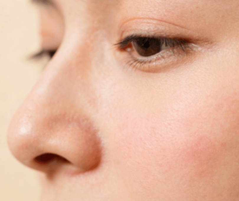 敏感肌修护,这3种核心成分必选,2种成分必避 敏感肌修护,这3种核心成分必选,2种成分必避