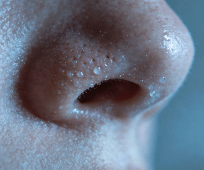 闭口反复：根源诱因与长效改善实操方案