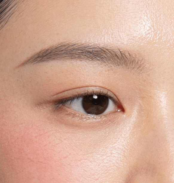 水油失衡不是“出油多”,这些成分用错越护越糟插图 水油失衡不是“出油多”,这些成分用错越护越糟插图