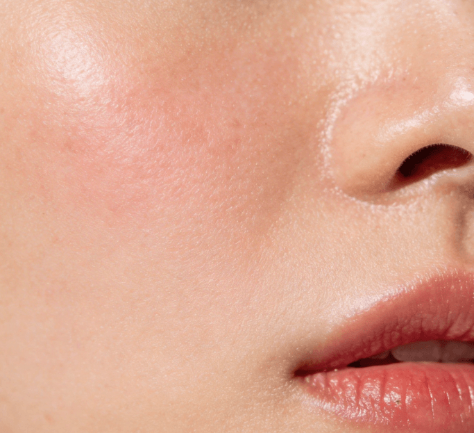 水油失衡vs外油内干:区别、成因与差异化调理方案 水油失衡vs外油内干:区别、成因与差异化调理方案