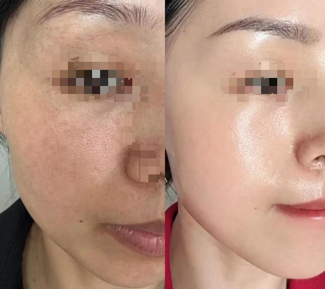 伊的家护肤达人常华军：用 9 年专业重新定义「科学变美」插图(2)