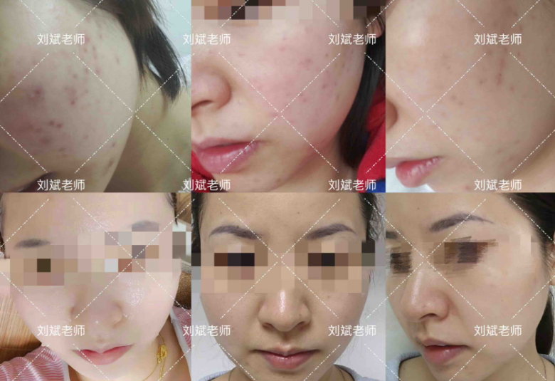 伊的家护肤达人刘斌：以科学为基，雕琢由内而外的健康美插图(3)
