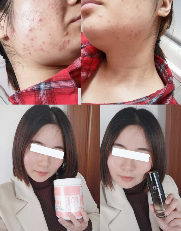 伊的家护肤达人绿绿：用实打实的专业，守护无数姐妹的肌肤健康插图(2)