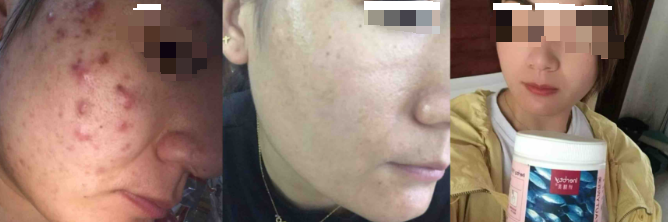 伊的家护肤达人李容均(小容老师)：以肤心同愈之念，做陪伴式护肤引路人插图(3)
