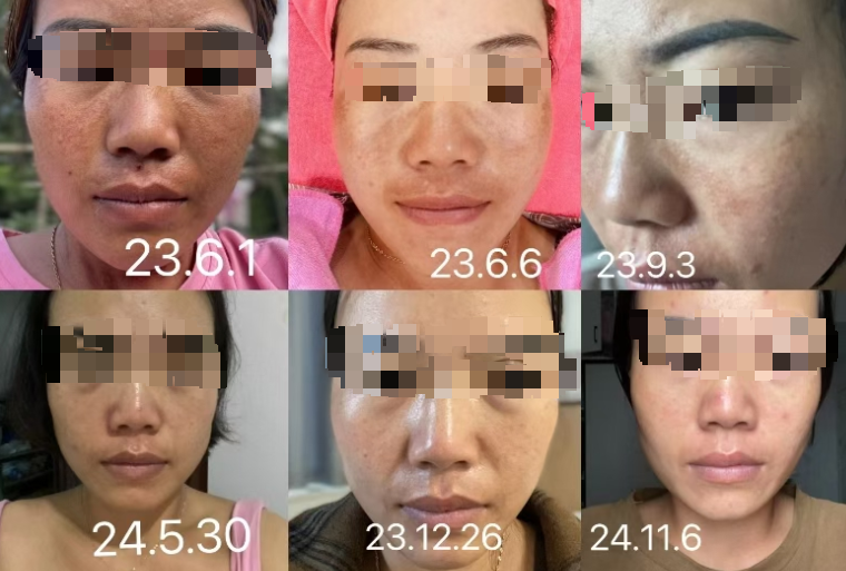 伊的家护肤达人詹旭创：十三年深耕护肤，内调外养守护女性好气色插图(2)