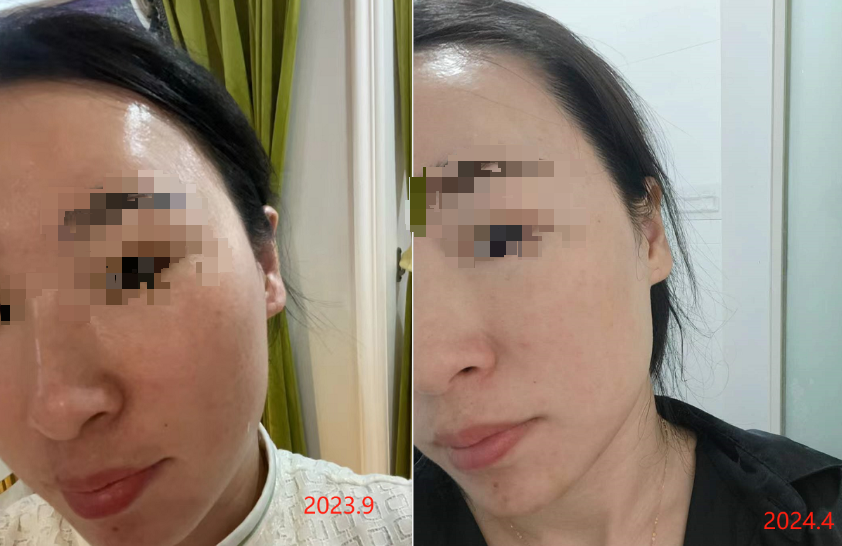 伊的家护肤达人何建军：十一年深耕，以科学护肤少走弯路插图(2)