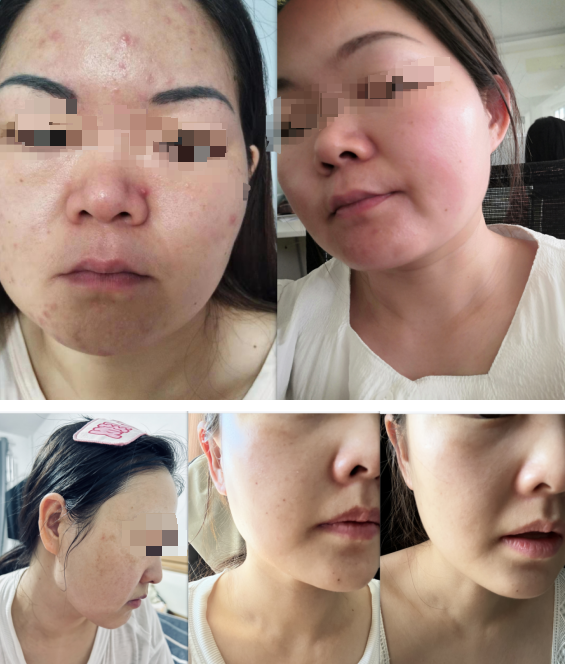 伊的家护肤达人牛海欢(小小老师):科学的养护体系,解锁由内而外的健康好肤质插图(2) 伊的家护肤达人牛海欢(小小老师):科学的养护体系,解锁由内而外的健康好肤质插图(2)