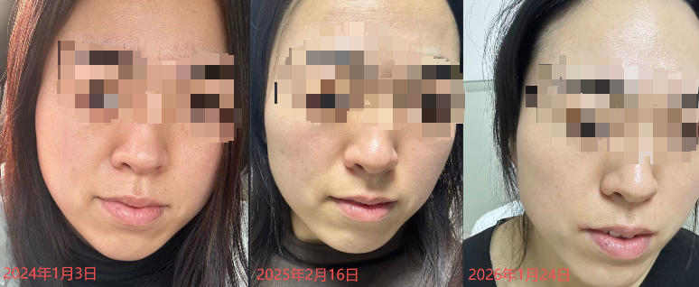 护肤达人泓乐:八载深耕,专业资质打底筑牢科学护肤根基插图(2) 护肤达人泓乐:八载深耕,专业资质打底筑牢科学护肤根基插图(2)