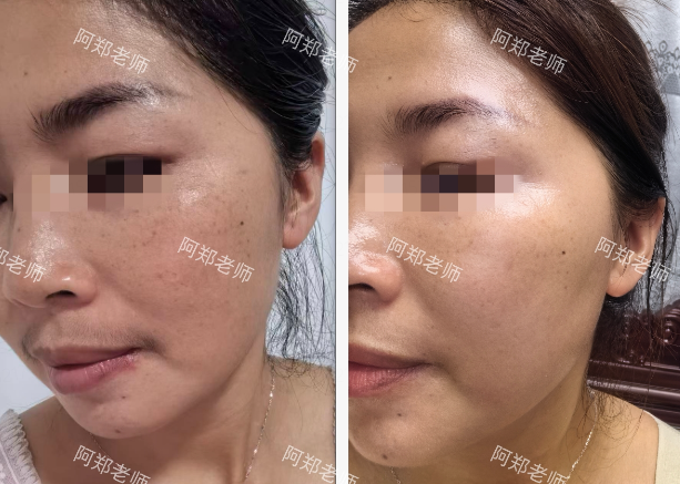 护肤达人郑保林:专注个性化肌肤管理与内外养护插图(2) 护肤达人郑保林:专注个性化肌肤管理与内外养护插图(2)